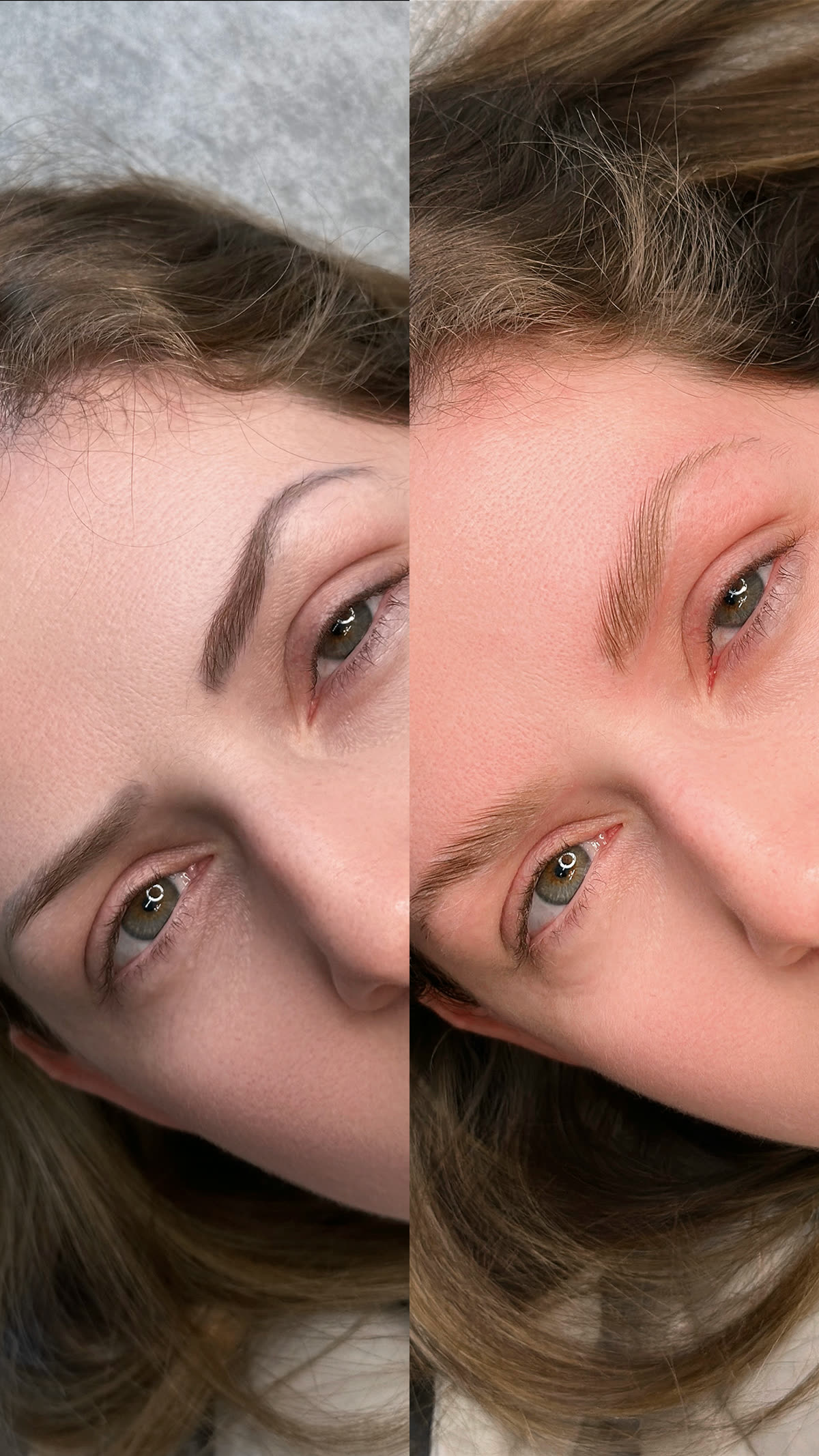 Remoção de Micropigmentação — antes e depois